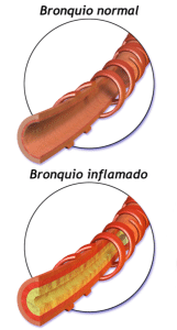 infecciones respiratorias